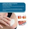 Ximonth Psoriasis Treatment Cream Repair Hand, Foot And Body Moss Redness And Itchy Skin Topical Treatment Cream