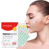 Pimple Patches,Pimple Patches For Face, Hydrocolloid Acne Patches, Cute Star Stickers Hydrocolloid Acne Pimple Patch For Covering Zits And Blemishes